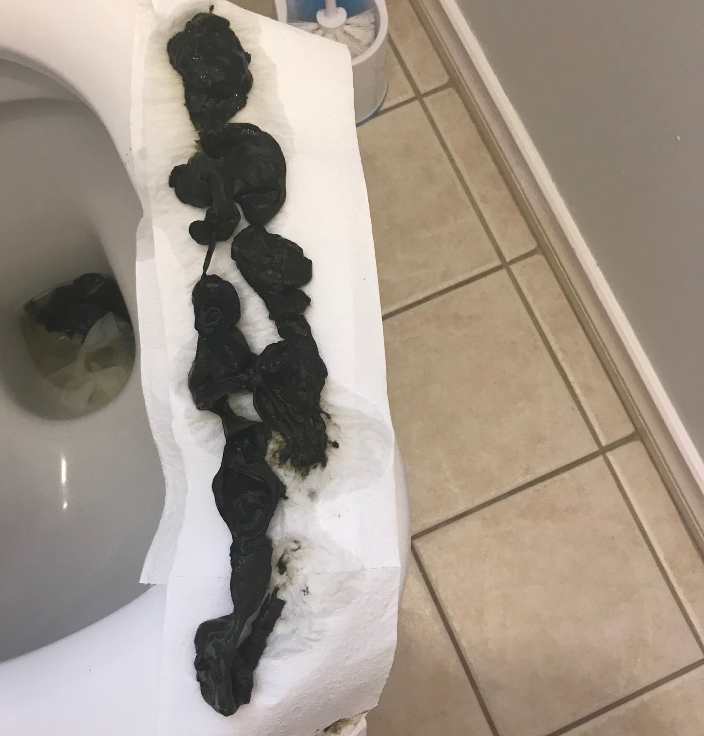 Fungal and Parasite Cleanse Guide (pdf)