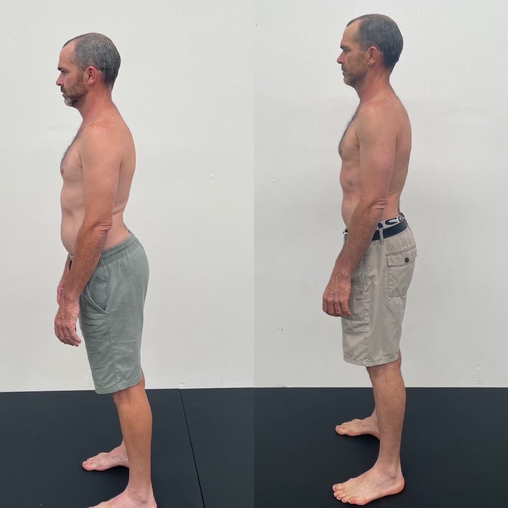 Posture Correction Program RESULTS