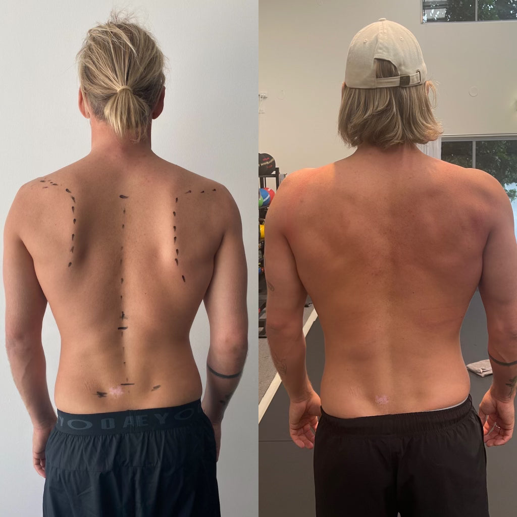 The Back Tracks Program Posture Perfect Checklist.pdf RESULTS